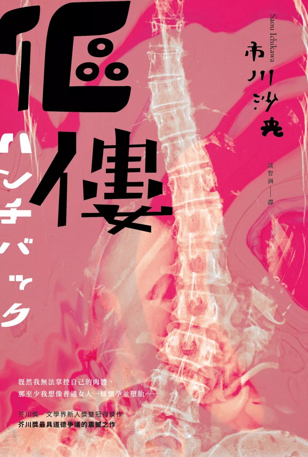 傴僂